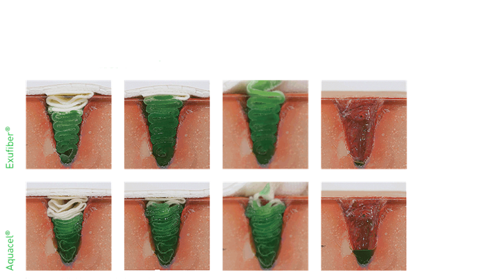 exufiber palyginimas su aquacel